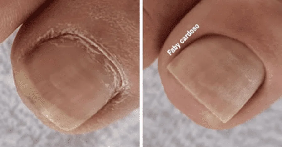 curso-de-pedicure-faby-cardoso curso-de-pedicure-faby-cardoso